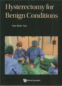 Image of Hysterectomy for benign conditions