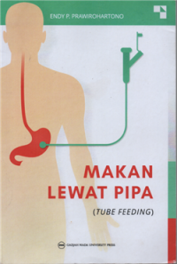 Image of Makan lewat pipa (tube feeding)