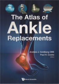 Image of The atlas of ankle replacements